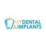 My Dental and Implants