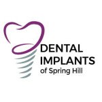 Dental Implants Spring Hill