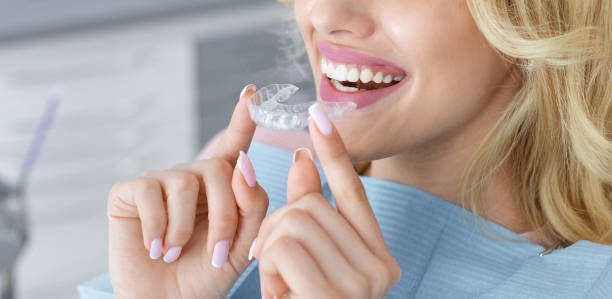 How Invisalign & Clear Braces Transform Smiles Discreetly – Telegraph