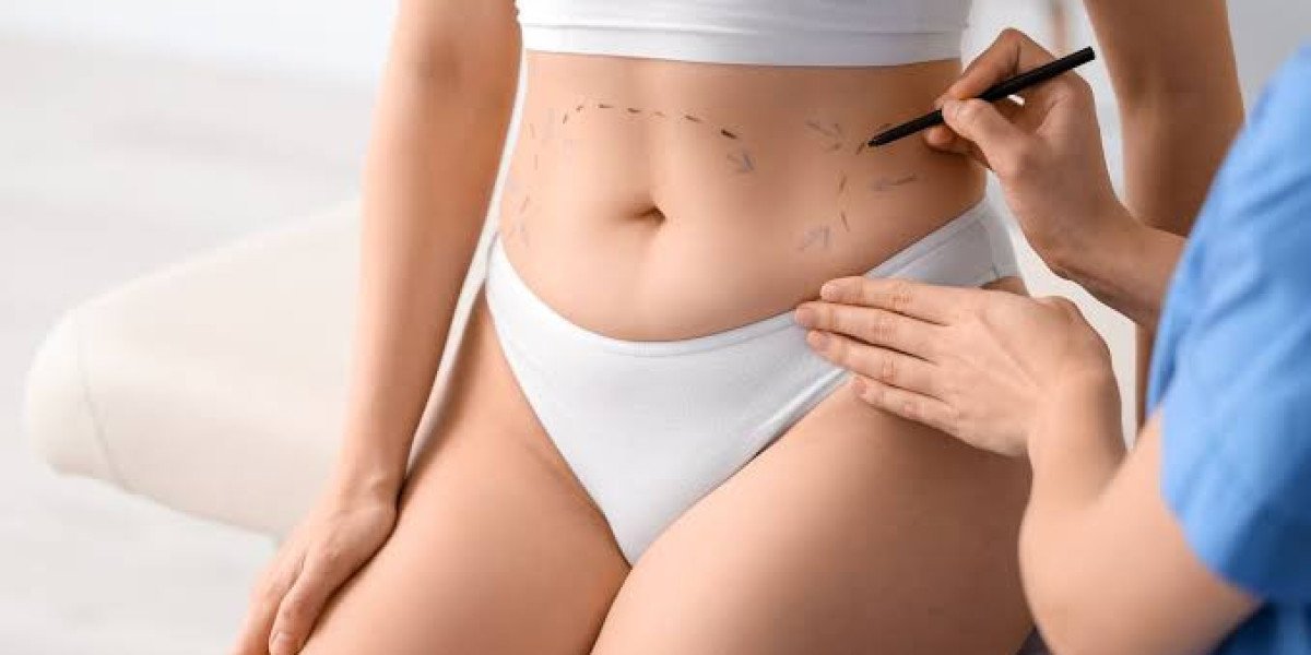 How a Tummy Tuck Can Restore Abdominal Shape After Weight Loss or Pregnancy