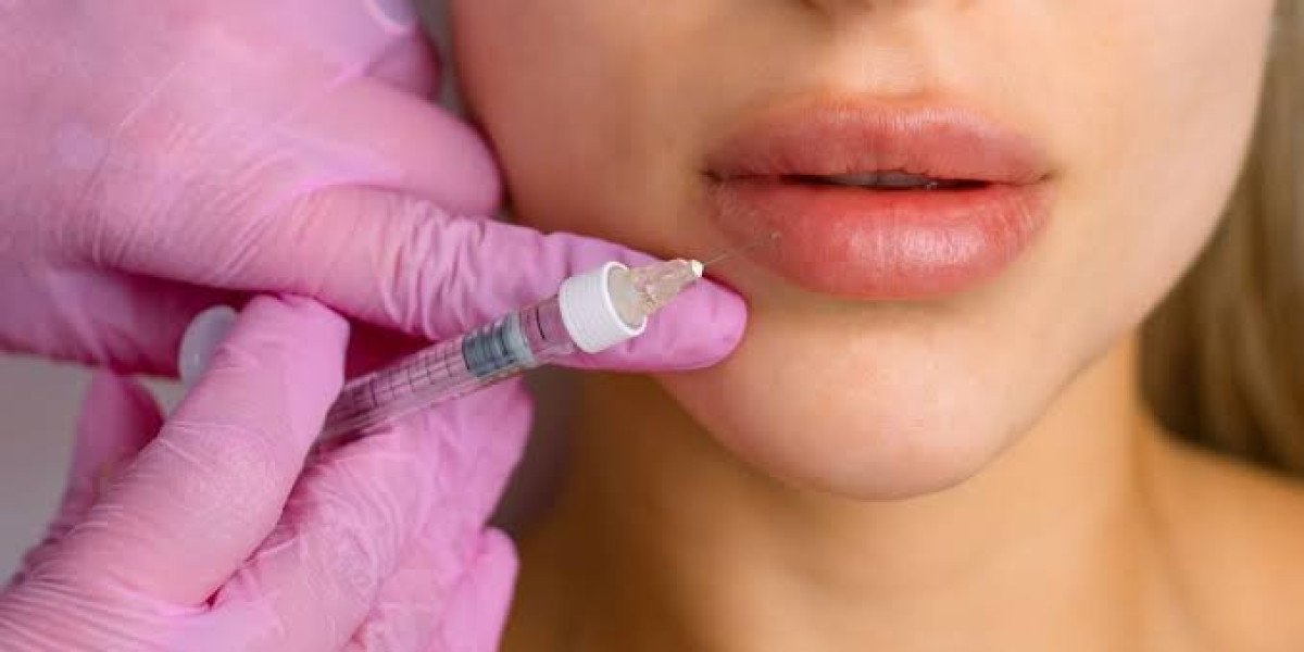 How Lip Fillers Injections Enhance Lip Shape, Volume, and Facial Balance