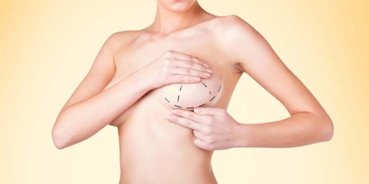 Breast Reduction in Dubai: How It Improves Quality of Life