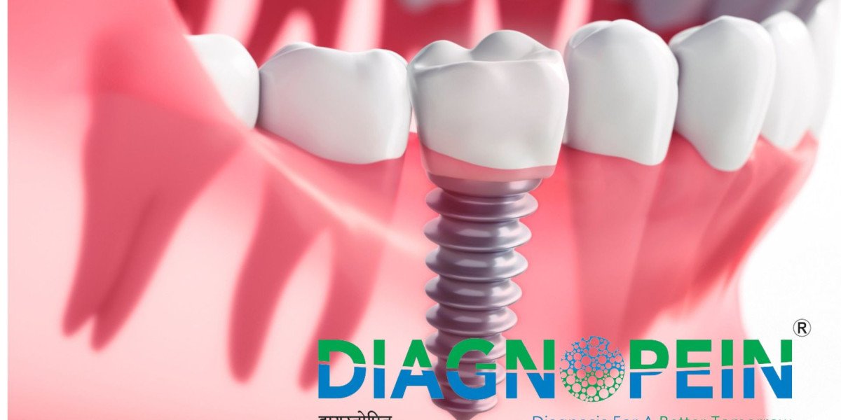 Best Dental Clinic in Mumbai for Affordable & Quality Treatment