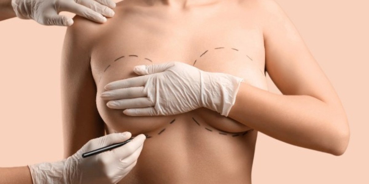 Breast Enlargement in Dubai: Fuller and Natural Curves