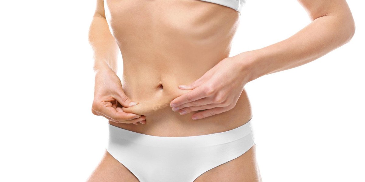 Liposuction in Dubai How Treatment Goals Shape the Surgical Approach