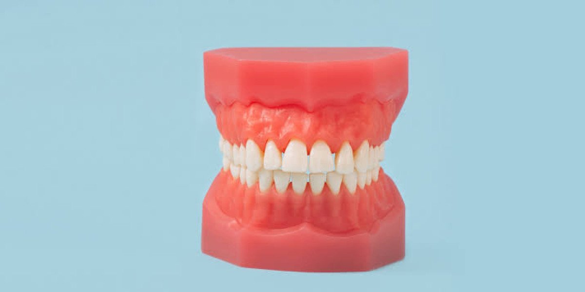 Partial Dentures Your Solution for Missing Teeth While Keeping Natural Ones in West Houston