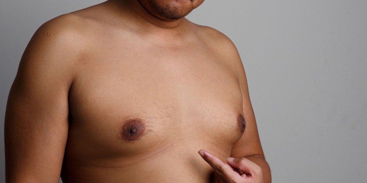 Gynecomastia Surgery Cost Guide For Men Considering Chest Refinement