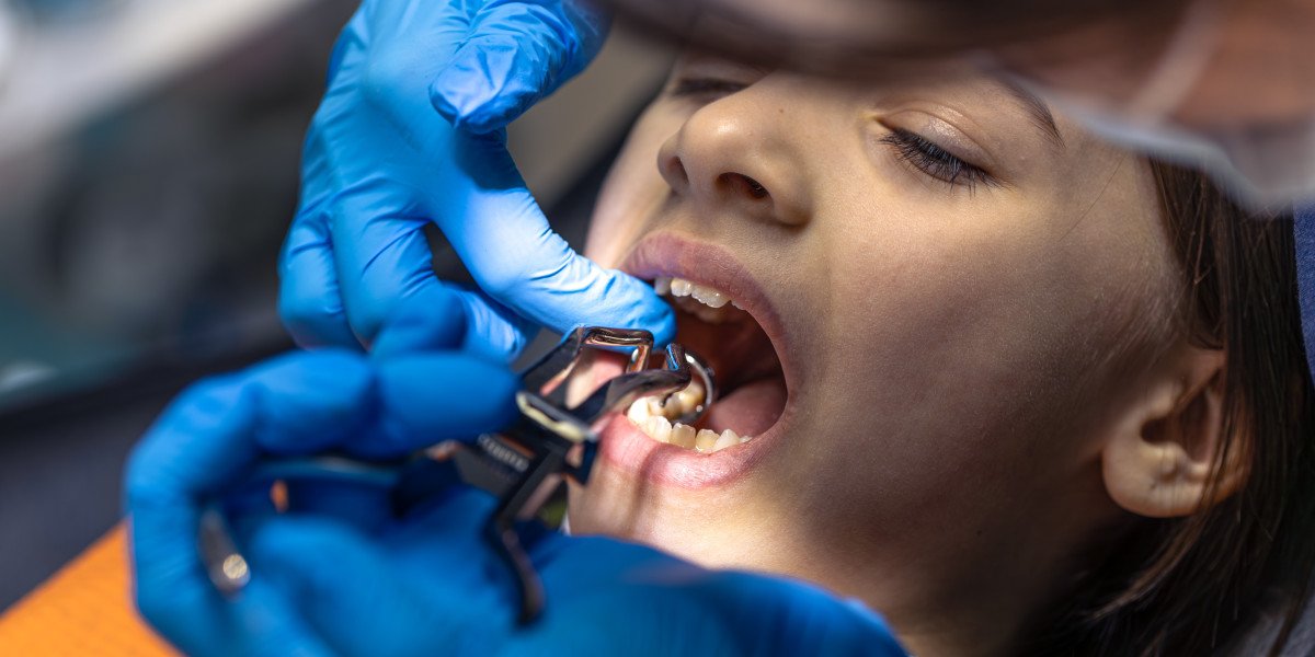 How to Prepare Your Child for a Tooth Extraction Without Increasing Dental Anxiety